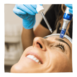 microneedling facial
