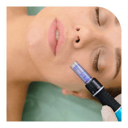 microneedling service to offer at your medspa