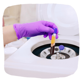 platelet-rich plasma therapy for medspas
